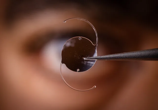 cataract lens correction
